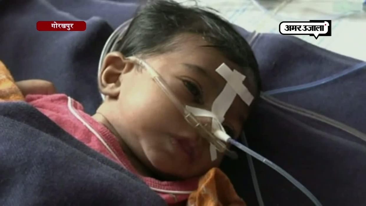 main highlights on gorakhpur brd hospital children's death