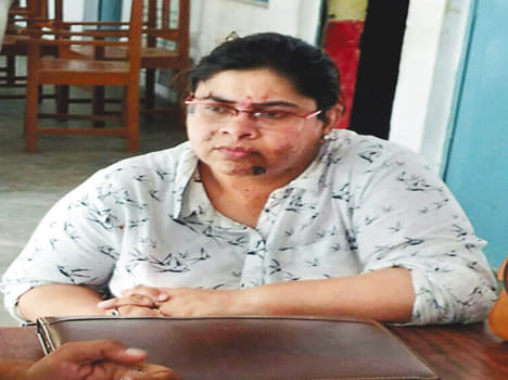Express tire burst on tire, home secretary injured