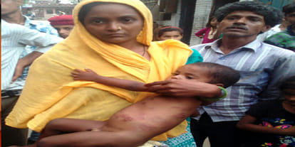 Yogi Governments promise made a deadly one and a half year old child