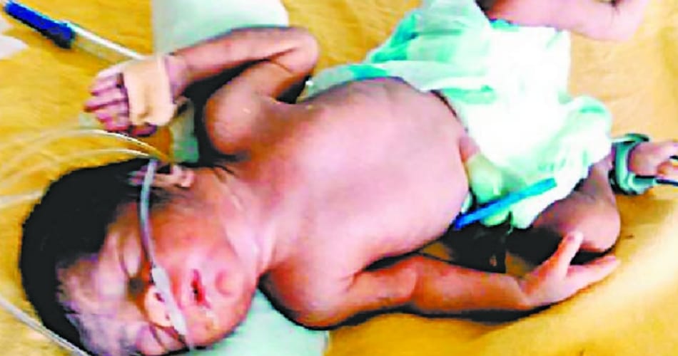 mother thrown new born girl child in bushes