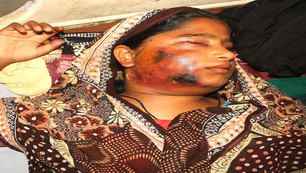 Tantrik beats teenager for treatment then Stained with hot coal in Bulandshahr
