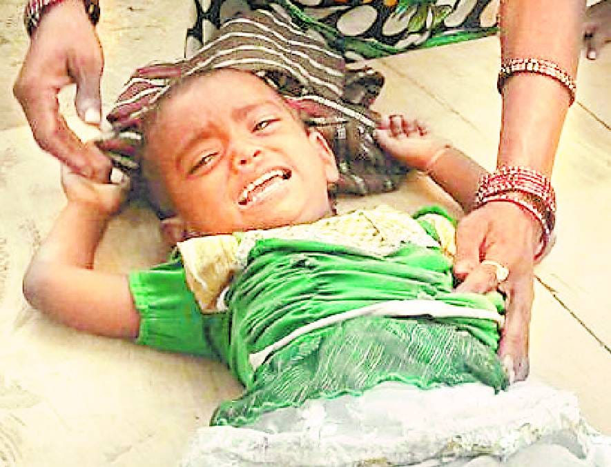 Diarrhea spread over village Palpur, 10 sick