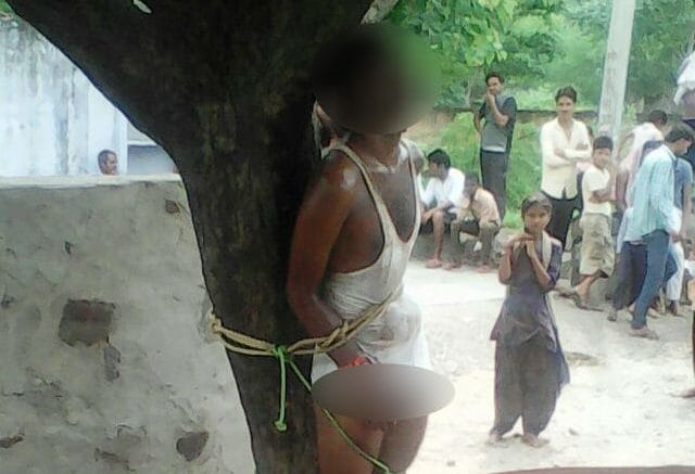 a boy beaten by girlfriend's parents