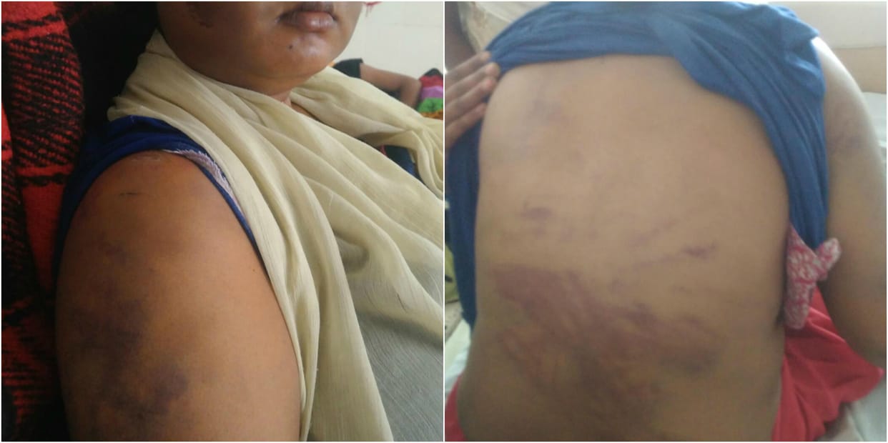 lady accused husband for domestic violence