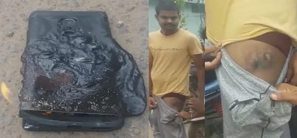 Xiaomi Redmi 4 again Explodes In Owner’s Pocket
