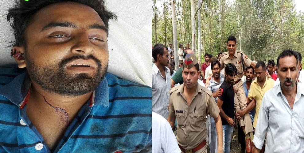 The accused was killed in the encounter, celebrating the SSP on the shoulders