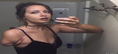 people crazy for handicapped girl yani Lauren Get marriage proposal