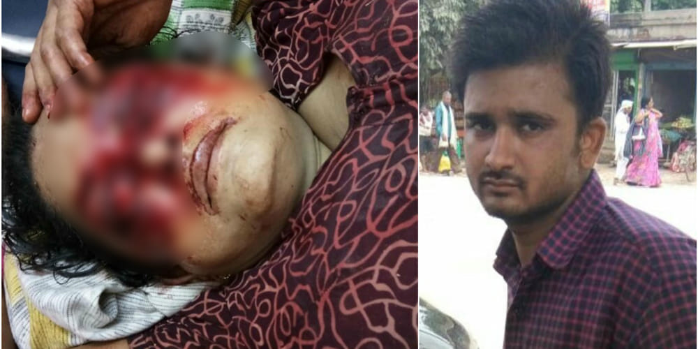 Varanasi son bursts both of his mother eyes, condition critical