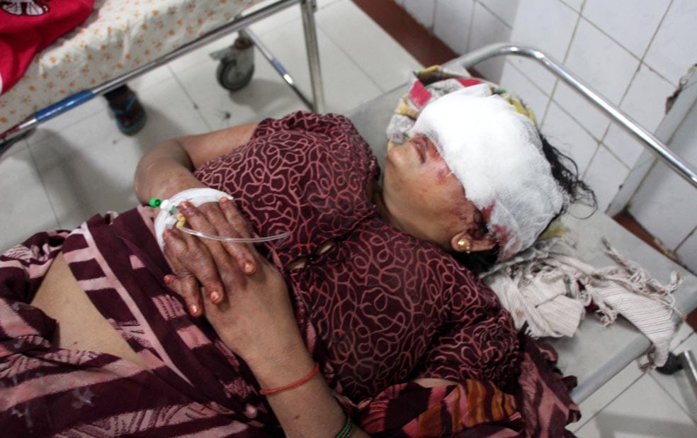 Son has attack on mothers eye in varanasi