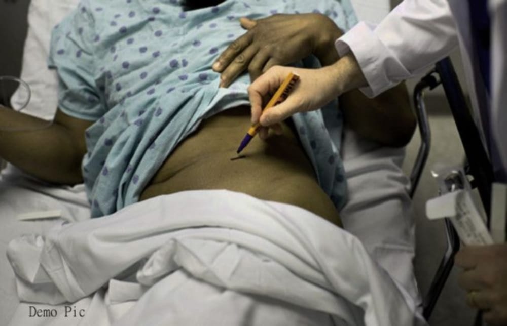 Wife Donate Kidney For Save Husband life in agra news