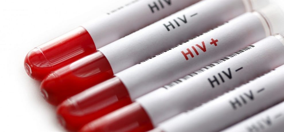 smartphone will detect hiv infection by using blood
