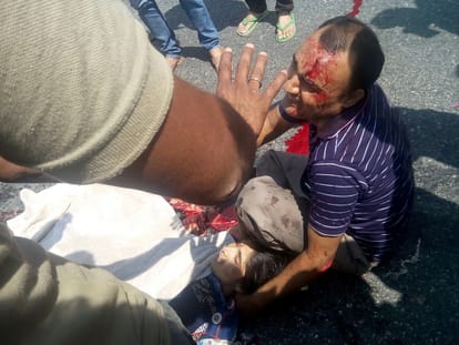 husband and wife lost their foot in a road accident in alwar 