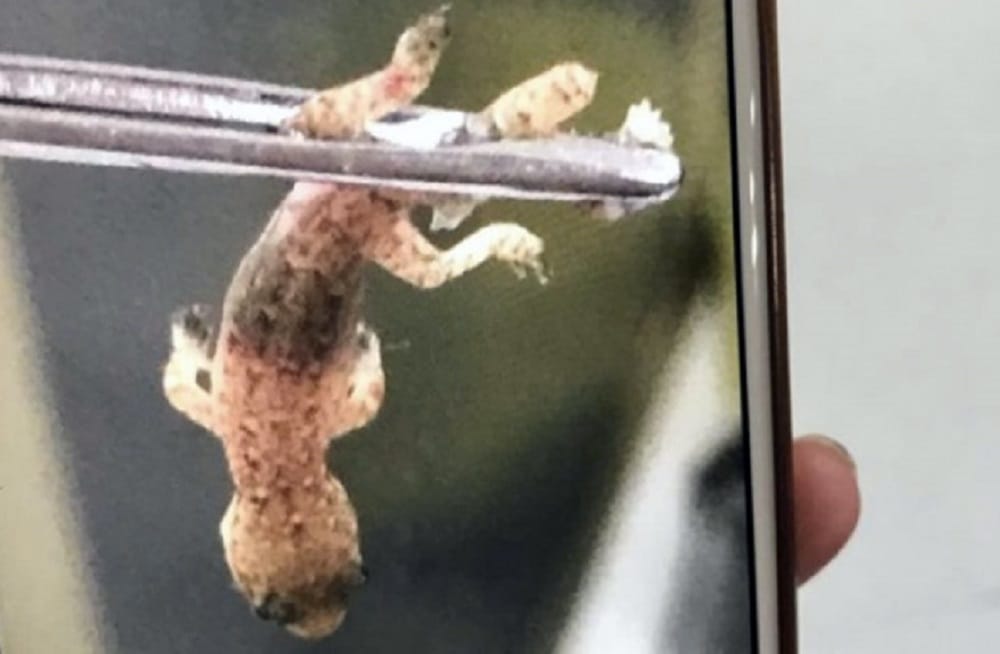 Live Gecko alias wall lizard removed from man ear