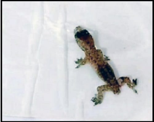 Live Gecko alias wall lizard removed from man ear