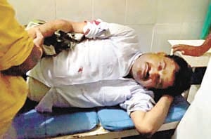 criminals burst fire on jwellery businessman