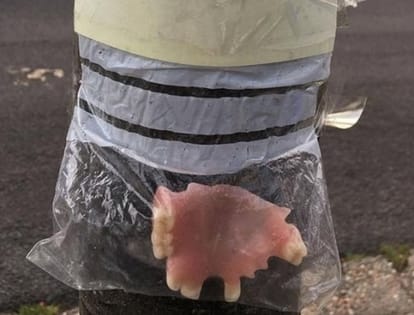 Woman found mysterious packet of teeth hanging in plastic from tree in England