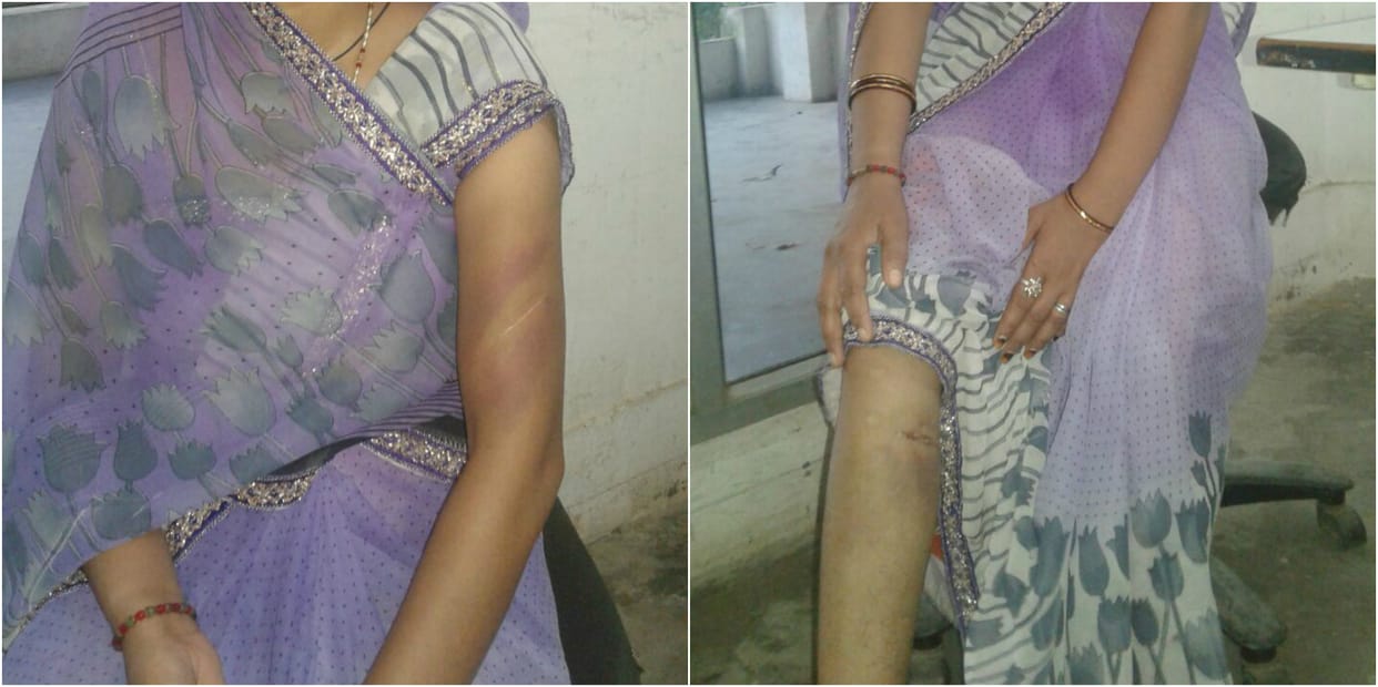 azamgarh brother rescued  sister who Torture for dowry