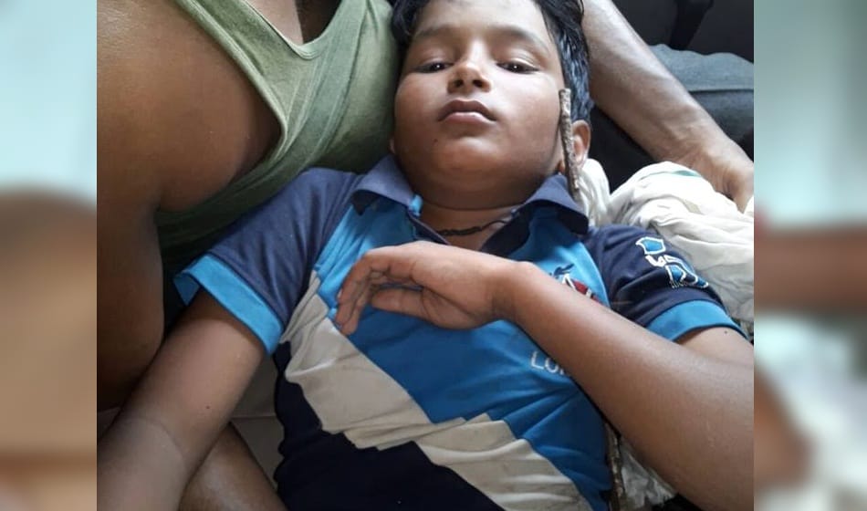 iron rod penetrate into 8th class student shoulder in greater noida