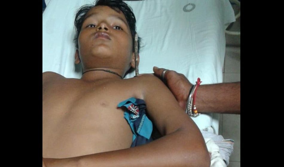 iron rod penetrate into 8th class student shoulder in greater noida