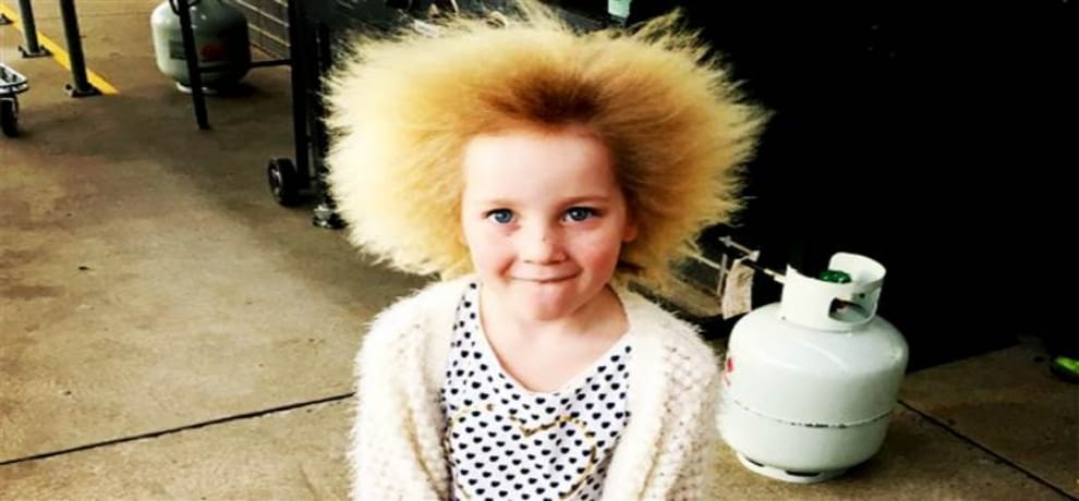 Uncombable hair of 7-year-old Girl