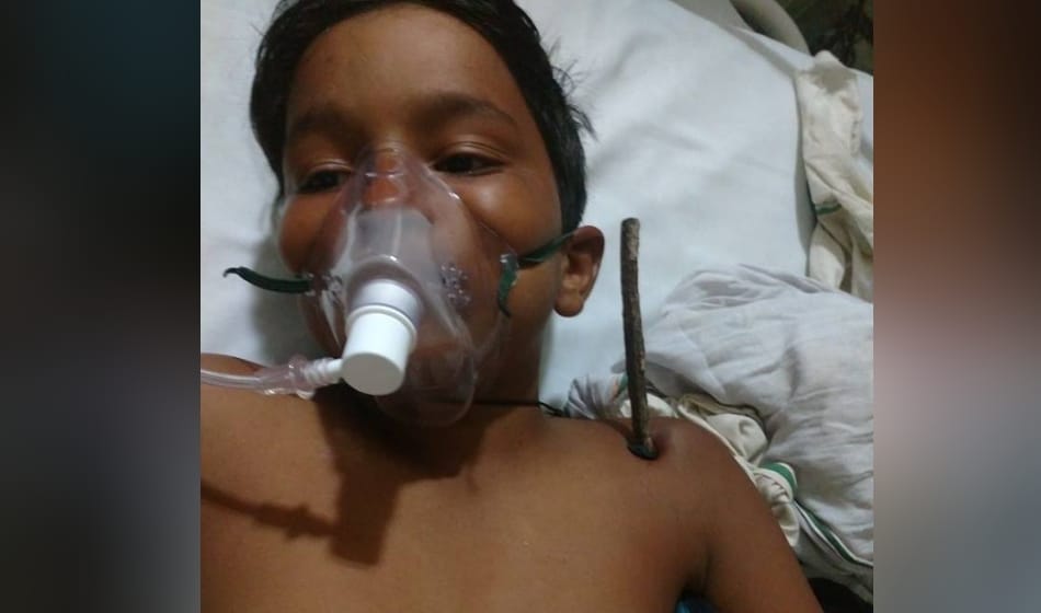 iron rod penetrate into 8th class student shoulder in greater noida