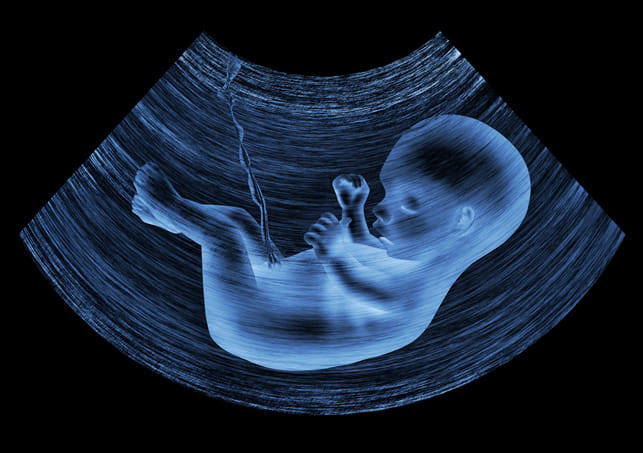 women recorded gender test process in camera