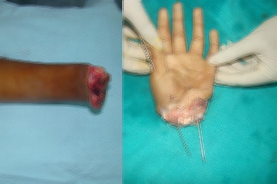 insane boy cuts hands of girl in lakhimpur