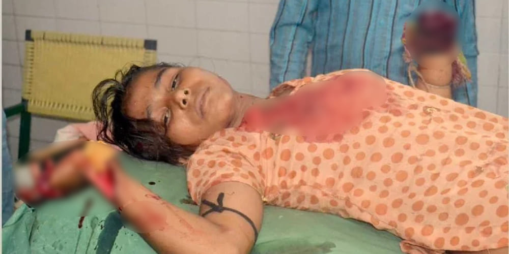 man chopped off girl hand and paw in one sided love in Lakhimpur kheri