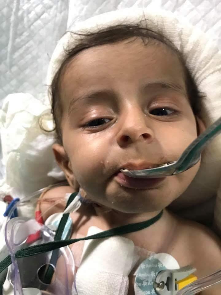lucknow pgi doctors treated afganistan kid