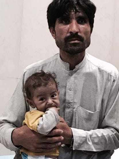 lucknow pgi doctors treated afganistan kid