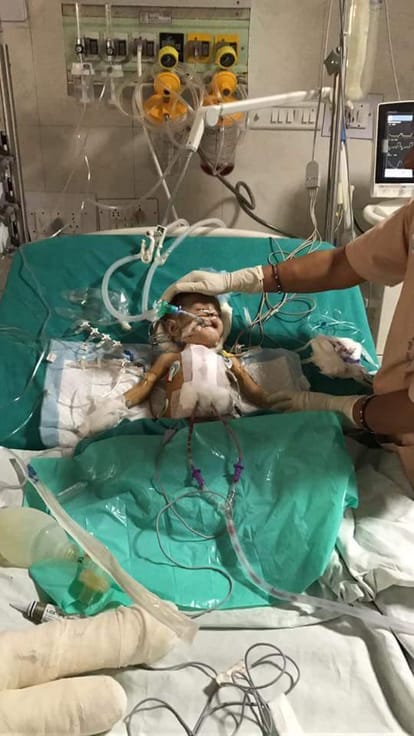 lucknow pgi doctors treated afganistan kid