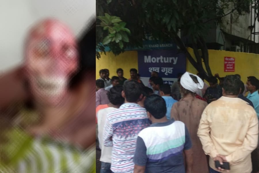 3 people arrested in lohia mortuary carelessness matter