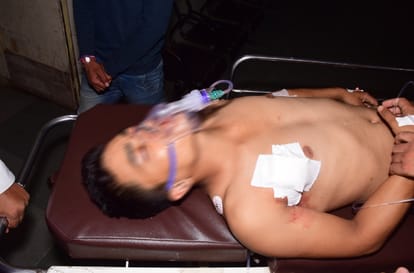 two youth shoot on psc soldier in haldwani