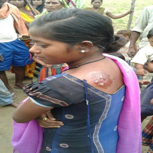 Five families were asleep in huts that suddenly caught fire, see photos