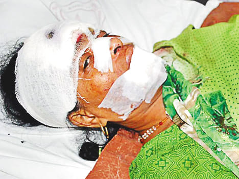 bykers looted bag from women