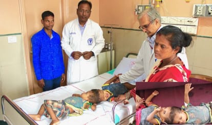 first round of surgery of twins attached with head successful in aiims delhi, it took 24 hours