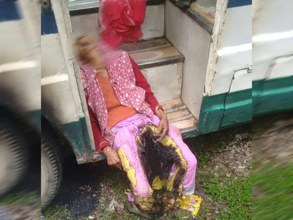 high tension electricity line fell on bus