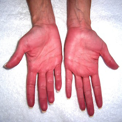 your palm colour say about your personality