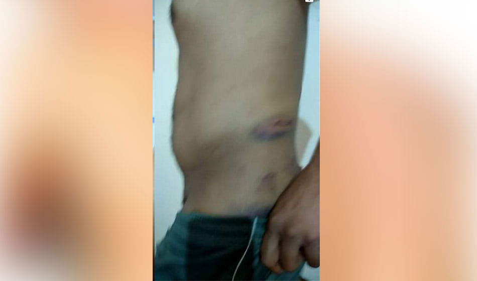 school warden beaten student from iron rod