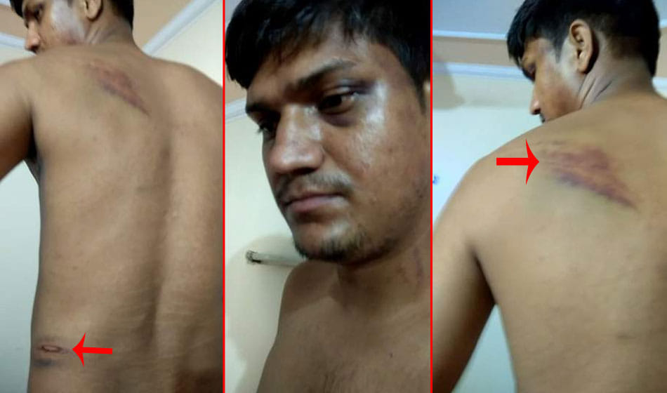 up police beaten army personnel after opposing forced collection in greater noida 