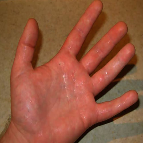 your palm colour say about your personality