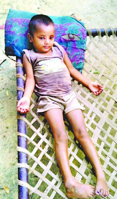 Two children die of fever, 24 children sick