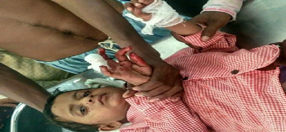 student not remember multiplication table teacher beaten Badly 