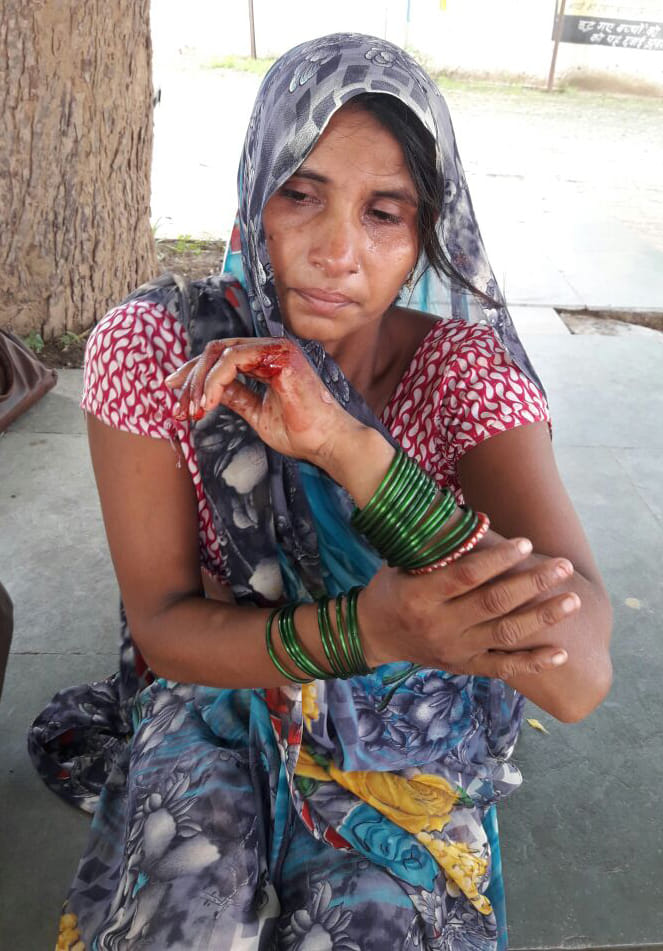 woman attacked by husband using screwdriver in agra 