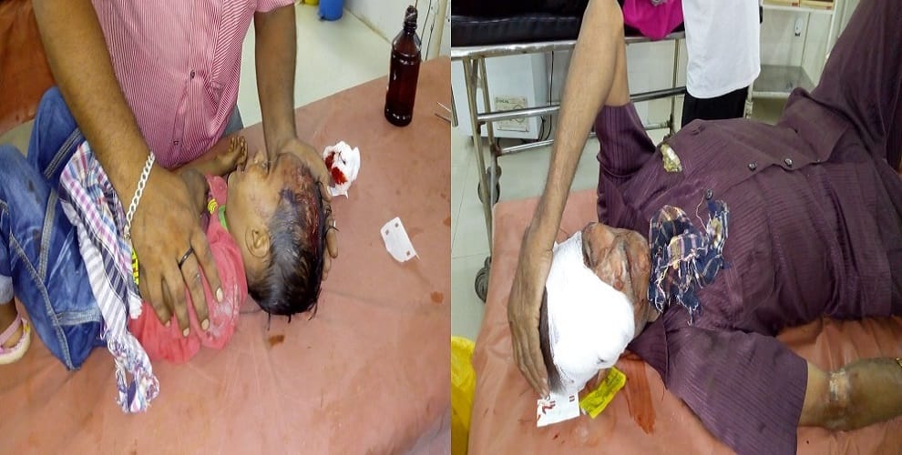 The death of a innocent girl came in the truck, three members of family injured