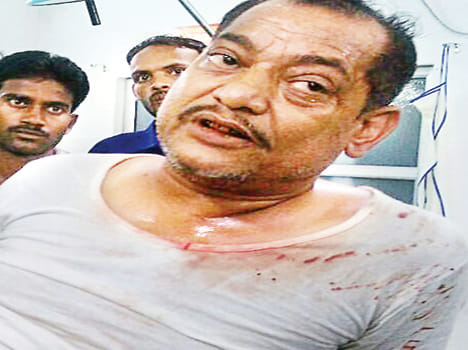 sand trader injured in fyring