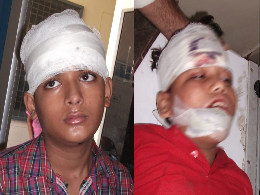 Exclusive photos of  bus and tempo accident in kashipur