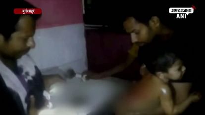 Doctor allegedly turns away child suffering burns in bulandshahr hospital
