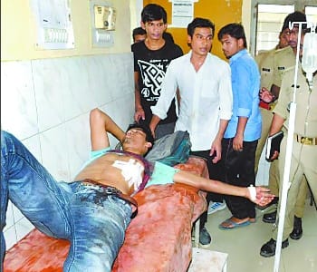 In a minor dispute the student hit the knife