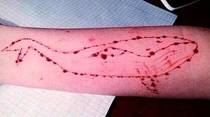 blue whale game affected school student admit in hospital